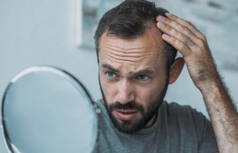 La phase de croissance du cheveu dure environ 2 à 5 ans chez l'homme et 3 à 7 ans chez la femme. (crédit : Adobe Stock)